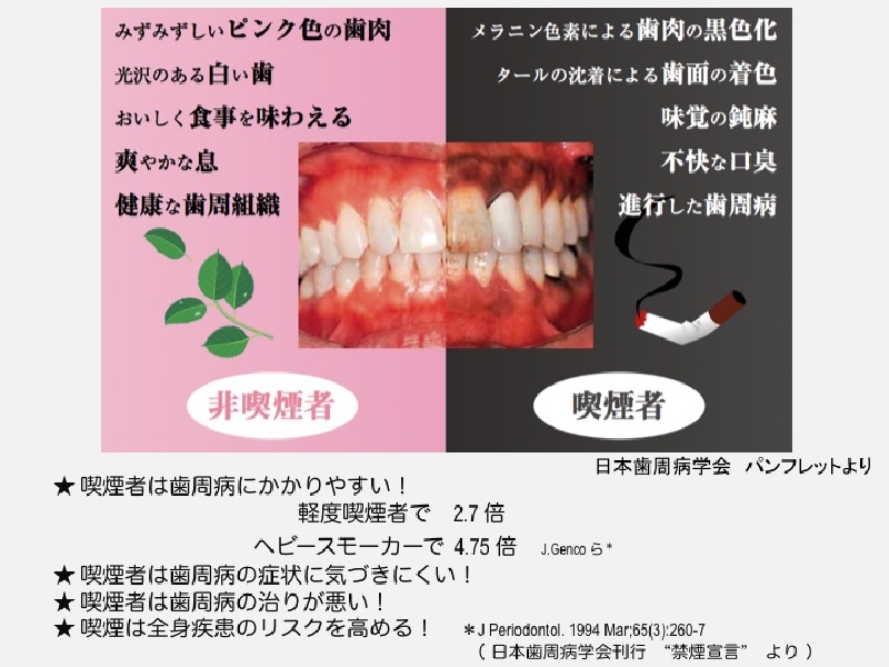 虫歯歯周病知覚過敏.jpg